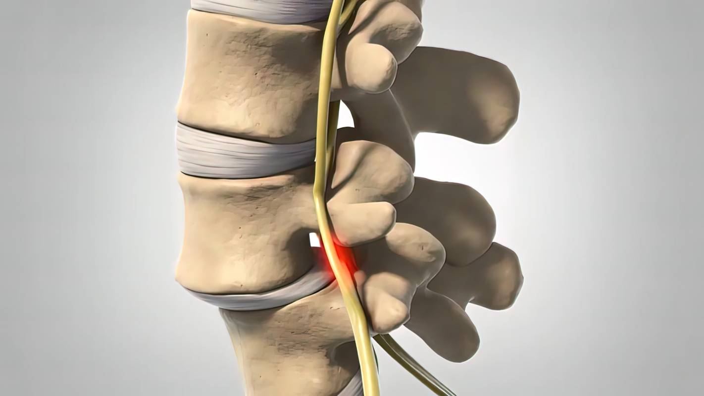 Urban Spine and Joint